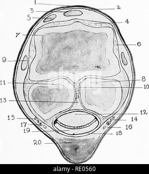 . Die chirurgische Anatomie des Pferdes... Pferde. Platte XI - Querschnitt über Fessel von "in der Nähe von "Vorder Extremität I. in der Haut. 2. Subkutane Faszien. 3. Sehne Der extensor Pedis. 4. Anterior gemeinsame Ligament der Fessel. 5. Sehne Der extensor suffraginis. 6. Seitliche Bänder der Fessel. 7. Große metacarpal Bone. 8. Innere sesamoid Bone. 9. Äußere Teilung der aufschiebende Ligament. 10. Intersesamoidean Ligament. 11. Äußere sesamoid Bone. 12. Sehne von flexor perforans Muskel. 13. Fibro - Knorpel. 14. Vordere Abteilung von plantar Nerv (anterior digitale Nerv). 15. Externe digitale Vene. 16. Int Stockfoto