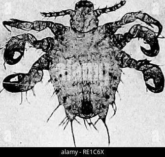 . Ein text-Buch auf die pathogenen Bakterien und Protozoen für Studenten der Medizin und Ärzte. Bakteriologie; pathogenen Bakterien und Protozoen. 53°zurückfallendes Fieber Ornithodorus savignyi ist vor allem ein Parasit des Kamels und nur gelegentlich beißt Mann; Ornithodorus moubata ist im Wesentlichen eine menschliche Pest. Die Eier dieser Zecken Luke in acht bis vierzehn Tage. Die Larve der über sechs Beine in die Eier verbracht und die Kreatur, die entsteht, ist in der Regel eine erste nymphalinston, die hat acht Beine. Nach dem Schlüpfen bleibt inaktiv für mehrere Tage, dann wird sehr aktiv und bereit Bl zu saugen Stockfoto