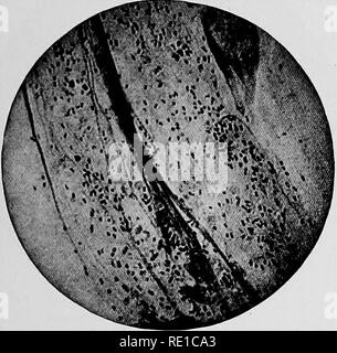 . Ein text-Buch auf die pathogenen Bakterien und Protozoen für Studenten der Medizin und Ärzte. Bakteriologie; pathogenen Bakterien und Protozoen. Anbau 48/in widdy zerstreut, aber dichten Cluster. Sie sind häufig innerhalb der Leukozyten umher. Es ist kaum notwendig, so langweilig eine Färbung Methode für den Nachweis der bacilU verfolgen, für die Sie gut genug für die Anerkennung durch die gewöhnlichen Methoden Fleck. Isolation. - Die influenza Bazillus wächst schlecht auf künstliche Kultur - Medien, und ist nicht einfach zu isolieren, weil die Bakterien es zu wachsen, neigen. Wenn er isoliert ist Stockfoto
