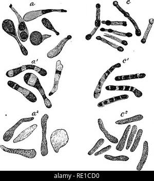 . Ein text-Buch auf die pathogenen Bakterien und Protozoen für Studenten der Medizin und Ärzte. Bakteriologie; pathogenen Bakterien und Protozoen. Kapitel XII DIPHTHERIE Bacillus Diphtherie (Klebs-Loffler) Synonyme.-- Bakterium diphtheriae-; Corynebacterium diphtheriae-, klebs-LofiBer Bazillus. Allgemeine Merkmale. - Eine nicht beweglich, nicht motivieren, nicht-sporogenous, nicht-cbromogenic, Aerogene, nicht verflüssigen, Aerobic, rein parasitären, Pathogene, toxicogenic bacSlus, Anbaufläche, auf der gewöhnlichen Nährmedien, Färbung, die von den gewöhnlichen Methoden und durch Gram's Methode. Im Jahr 1883 demonstrierten die Klebs * Stockfoto