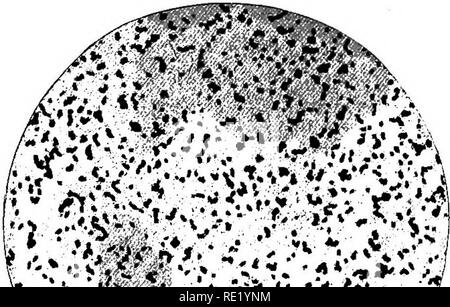 . Ein text-Buch auf die pathogenen Bakterien und Protozoen für Studenten der Medizin und Ärzte. Bakteriologie; pathogenen Bakterien und Protozoen. 694 Tuberkulose Isolierung und Kultivierung dieser Organismen ist einfach, und mehr als jede andere Maßnahme dient Ihnen aus den Tuberkelbazillus zu unterscheiden, da sie auf fast alle Kultur wachsen - Medien mit Schnelligkeit und Üppigkeit. PSEUDOTUBERCULOSIS Bacillus Pseudotuberculosis Pfeififer, *Malassez und Vignal, t Eberth, t Chantemesse, § Charrin, und Roger 11 haben alle gemeldeten Fälle von sogenannten pseudotuberculosis in Guinea vorkommenden - Schweine, und Charakter Stockfoto