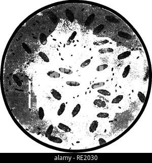 . Ein text-Buch auf die pathogenen Bakterien und Protozoen für Studenten der Medizin und Ärzte. Bakteriologie; pathogenen Bakterien und Protozoen. Chicken-Cholera 565 Läsionen. - Die Autopsie zeigt, dass, wenn die Bazillen eingeführt werden subcuta gleichzeitig eine wahre Septikämie Ergebnisse, mit der Bildung einer hämorrhagischen Exsudat und Gallertartige infiltration am Sitz der Impfung. Die Leber und Milz vergrößert; umschrieben, hämorrhagische und infiltriert Bereichen auftreten, in der Lunge, dem Darm zeigen eine intensive Entzündung mit rot und geschwollen Schleimhaut und gelegentliche Geschwüre folgende kleine Blutungen. P Stockfoto
