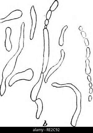 . Pflanzen und ihren Verwendungen; eine Einführung in die Botanik. Botanik; Botanik, Wirtschaftliche. 0^^" k k III. Abb. 151.- Hefe (Saccharomyces cerevisice, Hefe Familie, Saccharomyceta - Cece). a, einem einzigen Bier - Hefe Pflanze; stark vergrößert; h, gleichen Aussendung einer Knospe - wie Überstand; c, Gleiche mit Bud mehr entwickelt und eine zweite erscheinen; d, eine Kolonie von solchen angehende ohne Trennung produziert; e, eine Hefe Werk gliedert sich in vier innerhalb der en^' eloping Wand;/, eine Aufteilung in zwei, jeweils mit einer Wand, und damit in der Lage, ungünstige Bedingungen für eine lange Zeit zu widerstehen; g, ein Cluster von vier solchen widerstehen Stockfoto