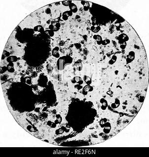 . Grundlagen der Botanik. Botanik. Abb. 315.- Die Organisation der flachen Wasseransammlungen in einem See der vorliegenden geologischen Epoche, die Überreste von Wurzeln, Blätter, etc. in der Nähe der Mitte der Figur kann einen Querschnitt der dreieckigen Nadel eines White Pine gesehen werden. (Vgl. Abbn. 316 und 317) (nach E.C. Jeffrey.). Abb. 316.- feine Dreck von unten von einem Teich, als unter dem zusammengesetzten Mikroskop gesehen, zeigt die Präsenz der Pollenkörner von Kiefer, Fichte und Tanne. (Vgl. Abbn. 315 und 317) (nach E.C. Jeffrey.). Bitte beachten Sie, dass diese Bilder aus gescannten Seite Bilder, die extrahiert werden Stockfoto