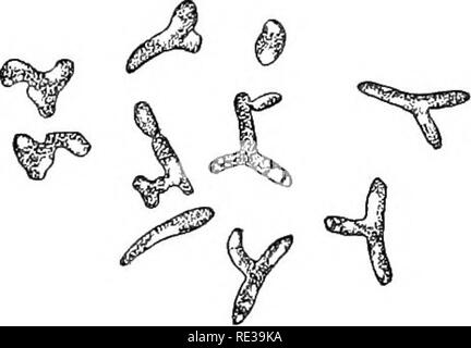 . Einführung in die Botanik. Botanik. 206 INTEODUCTION in die Botanik von Gewebe, so dass Sie Knötchen, oder tuberkel (Abbn. 167 und 168). Diese Withui tuberkel Bakterien sind in der Lage, die Unkombinierte Stickstoff aus der Luft von der Erde zu nehmen und es mit anderen Substanzen in einer Weise verbinden, wie Nitrate zu bilden. Die tuberkel Bakterien sind als die Stickstoff-fixierenden Bakterien bekannt, da sie frei von Stickstoff aus der Luft aufzunehmen und es mit anderen Dingen kombinieren, um pflanzliche Lebensmittel machen. Da die gewöhnliche Korn-Anlagen produzieren müssen Nitro-gen, um zu wachsen, und da Sie können es verwenden, um nur in der nitra Stockfoto