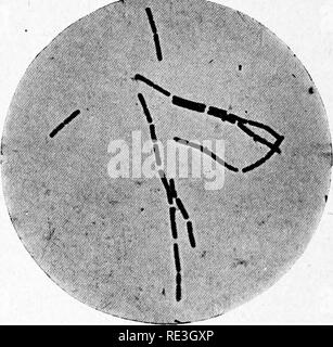 . Pathogene Mikroorganismen. Ein text-Buch der Mikrobiologie für Ärzte und Studenten der Medizin. (Auf Williams' Bakteriologie). Bakteriologie; pathogenen Bakterien. 28 o spezifische MIKROORGANISMEN Membran erzeugt, so charakteristisch, dass der Name "MESEN - tericus" zu dieser Art angewendet wurde. Es ist nicht pathogen. Bacillus Subtilis.-Bazillus suhtilis, oder das Heu Bacillus, reichlich vorhanden ist, in der Erde und auf der Oberfläche von Pflanzen, und gemeinsame im Oberflächenwasser und in der Luft. Es lässt sich durch kochendes Heu in Wasser, und stellen Sie anschließend die Infusion für ein paar Tage. Die Zelle ist Stockfoto