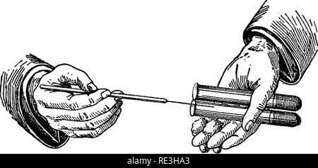 . Pathogene Mikroorganismen. Ein text-Buch der Mikrobiologie für Ärzte und Studenten der Medizin. (Auf Williams' Bakteriologie). Bakteriologie; pathogenen Bakterien. Die KULTIVIERUNG VON MIKROORGANISMEN III Teil der zu untersuchende Material-pus, zum Beispiel - und das mit einer sterilen Platin Draht oder Schleife in eine der Röhren vorstellen. Den Stecker des Test-tube ist zurückgenommen, leichtes Verdrehen, wobei es zwischen der dritten und vierten Finger der linken Hand, mit dem Teil, der Projekte in die Röhre, der Auf-Station die Rückseite der Hand. Es darf nicht zugelassen werden, dass jede obj Touch Stockfoto