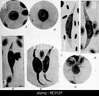 . Pathogene Mikroorganismen. Ein text-Buch der Mikrobiologie für Ärzte und Studenten der Medizin. (Auf Williams' Bakteriologie). Bakteriologie; pathogenen Bakterien. SPOROZOA435 eine erythroblast, einer unreifen roten Blutkörperchen, in denen es kaum oder keine Hämoglobin. Wie der parasit sich vergrößert, der Host Cell be-kommt, geschwollene ein '4 Kern deutlich abgeflacht und verzerrt. Die Parasiten selbst wächst Lange und eher schlank und wird differenziert. Schwein. 194.: - Hamoproteus (Leukocylozoon) ziemanni im Blut einer Eule mit £ (, reine Infektion. Eine junge Parasiten in einem erythroblast. B, wachsende Stockfoto