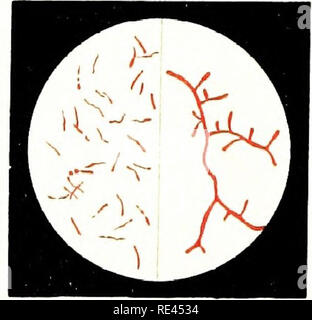 . Atlas und Grundsätze der Bakteriologie und Text - das Buch der besonderen bakteriologische Diagnostik. Die Bakteriologie. . Bitte beachten Sie, dass diese Bilder sind von der gescannten Seite Bilder, die digital für die Lesbarkeit verbessert haben mögen - Färbung und Aussehen dieser Abbildungen können nicht perfekt dem Original ähneln. extrahiert. Lehmann, K. B. (Karl Bernhard), 1858-1940; Neumann, Rudolf Otto, 1868 - Gemeinsame Thema; Weaver, George H. (George Howitt), b. 1866 hrsg. Philadelphia und London, W. B. Saunders &Amp; Company Stockfoto