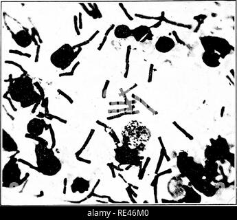 . Ein Lehrbuch der Bakteriologie; eine praktische Abhandlung für Studierende und Praktiker der Medizin. Die Bakteriologie. 566 pathogener Mikroorganismen ist vergleichsweise einfach, sowohl wegen der Einfachheit des Anbaus und wegen der stark Charakteristisch für seine morphologische und kulturellen Erscheinungsbild. Anbau.- Die anthrax Bacillus ist eine aerobe, fakultativ anaero-bic Bazillus. WTiile kann es langsam und dünn unter anaeroben Bedingungen entwickeln, freien Sauerstoff erforderlich ist seine üppige und Verwen-teristic Wachstum zu ermöglichen. Die optimale Temperatur für den Anbau reicht über 37,5° Stockfoto