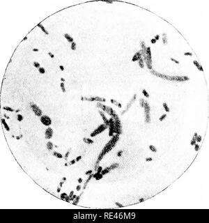 . Ein Lehrbuch der Bakteriologie; eine praktische Abhandlung für Studierende und Praktiker der Medizin. Die Bakteriologie. 556 pathogene Mikroorganismen spezielle Methoden, eine gallertartige Kapsel zu besitzen. Nicht fiagella besitzen und keine Sporen bilden. Die Pest Bazillus ist leicht mit allen üblichen Anilin Farbstoffen gefärbt. Verdünnte wässrige Fuchsin und Dichlormethan - Blau werden am häufigsten eingesetzt. Mit diesen Flecken der Charakteristisch tiefer Färbung der polaren Anteile der Bazillus ist in der Regel leicht zu demonstrieren. Spezielle polar Flecken sind von verschiedenen Beobachtern entwickelt. Die meisten dieser d Stockfoto