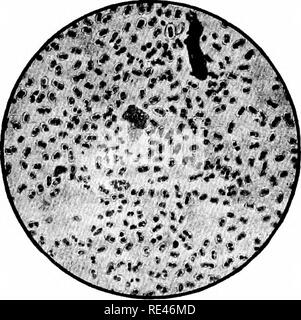 . Ein Lehrbuch der Bakteriologie; eine praktische Abhandlung für Studierende und Praktiker der Medizin. Die Bakteriologie. BACILLUS PEStIS 555 Kitasato^ und durch Yersin,^ unabhängig voneinander. Von beiden ob-Servern der Bazillus, der ausnahmslos in der Eiter aus dem buboes der Betroffenen gefunden werden konnte. Es könnte zu enormen Zahlen in den Leichen der Opfer gezeigt werden. Die Konstanz der Auftreten der Bazillus bei Patienten, die in den zahllosen gezeigt Forschungen vieler Bakteriologen, würde allein ausreichende Beweise für seine ätiologische Beziehung zur Krankheit werden. Dieser Nachweis ist strengthene Stockfoto