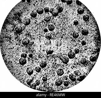 . Ein Lehrbuch der Bakteriologie; eine praktische Abhandlung für Studierende und Praktiker der Medizin. Die Bakteriologie. Bazillus INFLUENZAE 539 Dieser Bazillus, der wegen seiner nahrhaften Qualitäten und nicht durch seine Sauerstoff Eigenschaften. Obwohl die Anwesenheit von Hemo-globin scheint eine Notwendigkeit für die erfolgreiche Kultivierung des Bazillus, die Menge präsentieren müssen nicht sehr groß sein. Ghon und Preyss" zeigte, dass ein Betrag zu klein gezeigt werden Spektroskopisch für sein Wachstum aus. Andere Stoffe, die zu einem neutralen oder leicht alkalischen Agar hinzugekommen sind, haben für die culti verwendet. Stockfoto