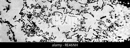 . Ein Lehrbuch der Bakteriologie; eine praktische Abhandlung für Studierende und Praktiker der Medizin. Bakteriologie. beleuchtet.^-*^. rV'^ • s-Abb. 105.- Bazillus Diphtherie. Die alle ist es wichtig zu famihar werden. Diese Schwankungen sind, in begrenztem Umfang, abhängig vom Alter der Kultur und auf die Verfassung der Medium, auf dem es angebaut wurde. Diese Faktoren jedoch nicht die Erscheinung des Organismus mit einer gewissen Regelmäßigkeit, und alle oder einzelne seiner verschiedenen Formen können in ein und derselben Kultur auftreten. Es ist wahrscheinlich, dass diese verschiedenen Erscheinen- Stufen t dar Stockfoto