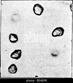 . Ein Lehrbuch der Bakteriologie; eine praktische Abhandlung für Studierende und Praktiker der Medizin. Die Bakteriologie. Bazillus von TYPHUS 407 Obwohl sehr gut selbst, kann ein Faktor für die Ausbreitung der Krankheit. Solche Fälle wurden zum Hafen bekannt, die Bazillen für Zeiträume von mehreren Jahren. Die Prüfung selbst ist voll mit großen Schwierigkeiten, da die Zahl der Doppelpunkt preponderating bacilU in allen Fäkalien und die Schwierigkeiten bei der Isolierung des Typhus Bazillen aus solchen Mischungen gefunden. Überprüfung der Daten von einer Reihe von Forschern gesammelt wurden, scheint es wahrscheinlich, dass die Bazillen tun Stockfoto