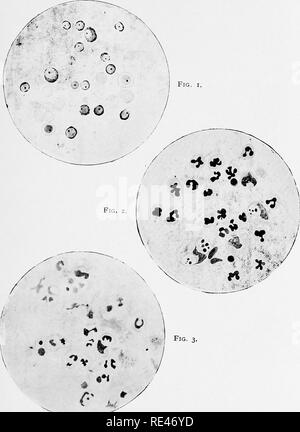 . Klinische Bakteriologie und Hämatologie für Praktiker. Bakteriologie; Hämatologie. Platte IX. Bitte beachten Sie, dass diese Bilder sind von der gescannten Seite Bilder, die digital für die Lesbarkeit verbessert haben mögen - Färbung und Aussehen dieser Abbildungen können nicht perfekt dem Original ähneln. extrahiert. Schmirgel, Walter d'Este. London, Lewis Stockfoto