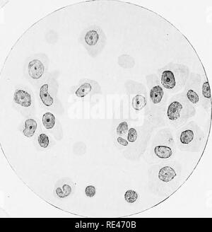 . Klinische Bakteriologie und Hämatologie für Praktiker. Bakteriologie; Hämatologie. Platte X./." • v&lt; l B'^ Abb. 2. y Abb. I..n Bild. 3.. Bitte beachten Sie, dass diese Bilder sind von der gescannten Seite Bilder, die digital für die Lesbarkeit verbessert haben mögen - Färbung und Aussehen dieser Abbildungen können nicht perfekt dem Original ähneln. extrahiert. Schmirgel, Walter d'Este. London, Lewis Stockfoto