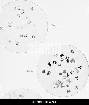 . Klinische Bakteriologie und Hämatologie für Praktiker. Bakteriologie; Hämatologie. Platte IX. : * V u 0 Abb. 3. "* I r--. EIN "^,. Bitte beachten Sie, dass diese Bilder sind von der gescannten Seite Bilder, die digital für die Lesbarkeit verbessert haben mögen - Färbung und Aussehen dieser Abbildungen können nicht perfekt dem Original ähneln. extrahiert. Schmirgel, Walter d'Este. London, Lewis Stockfoto