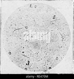 . Klinische Bakteriologie und Hämatologie für Praktiker. Bakteriologie; Hämatologie. Abb. I.. Abb. 2.. Bitte beachten Sie, dass diese Bilder sind von der gescannten Seite Bilder, die digital für die Lesbarkeit verbessert haben mögen - Färbung und Aussehen dieser Abbildungen können nicht perfekt dem Original ähneln. extrahiert. Schmirgel, Walter d'Este. London, Lewis Stockfoto