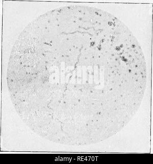 . Klinische Bakteriologie und Hämatologie für Praktiker. Bakteriologie; Hämatologie. Platte V.. Abb. I.. Bitte beachten Sie, dass diese Bilder sind von der gescannten Seite Bilder, die digital für die Lesbarkeit verbessert haben mögen - Färbung und Aussehen dieser Abbildungen können nicht perfekt dem Original ähneln. extrahiert. Schmirgel, Walter d'Este. London, Lewis Stockfoto