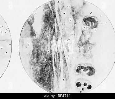 . Klinische Bakteriologie und Hämatologie für Praktiker. Bakteriologie; Hämatologie. Abb. 3. Abb.. Bitte beachten Sie, dass diese Bilder sind von der gescannten Seite Bilder, die digital für die Lesbarkeit verbessert haben mögen - Färbung und Aussehen dieser Abbildungen können nicht perfekt dem Original ähneln. extrahiert. Schmirgel, Walter d'Este. London, Lewis Stockfoto