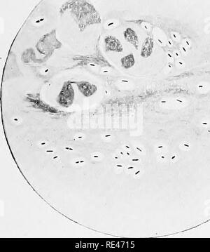 . Klinische Bakteriologie und Hämatologie für Praktiker. Bakteriologie; Hämatologie. Abb. I. in Abb. 2.. Bitte beachten Sie, dass diese Bilder sind von der gescannten Seite Bilder, die digital für die Lesbarkeit verbessert haben mögen - Färbung und Aussehen dieser Abbildungen können nicht perfekt dem Original ähneln. extrahiert. Schmirgel, Walter d'Este. London, Lewis Stockfoto
