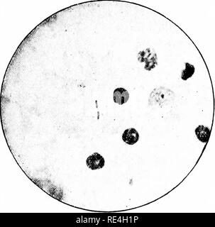 . Mikroorganismen und Krankheit. Eine Einführung in die Untersuchung von bestimmten Mikroorganismen. Mikroorganismen. Ich iG Si. - Film Specit^ ien von Sim.Een in Typhus; Kerne axd-Cell^ OE Sl' LEEi PlLP, zwei Tvi 'HOID Bazillen.. Bitte beachten Sie, dass diese Bilder sind von der gescannten Seite Bilder, die digital für die Lesbarkeit verbessert haben mögen - Färbung und Aussehen dieser Abbildungen können nicht perfekt dem Original ähneln. extrahiert. Klein, E. (Edward), 1844-1925. London, Macmillan und Co., Ltd. Stockfoto