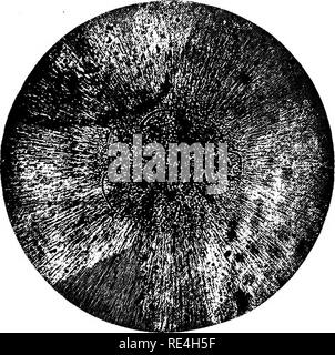 . Ein text-Buch auf die pathogenen Bakterien und Protozoen für Studenten der Medizin und Ärzte. Bakteriologie; pathogenen Bakterien und Protozoen. 342 Tetanus vierundzwanzig Stunden, während welcher Zeit alle enthaltenen Mikroorganismen, einschließlich der tetanus Bacillus, Zahl gestiegen. Er ausgesetzt ist, eine Stunde lang auf eine Temperatur von 8°C, durch das alle voll entwickelten Bakterien, Tetanus ebenso wie die anderen, und die große Mehrheit der Sporen, wurden zerstört. Wie kaum etwas anderes als die Tetanus- Sporen lebendig geblieben, deren anschließende Wachstum gab eine ziemlich Kultur pur. Anbau.- Die tetanu Stockfoto