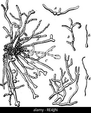 . Ein text-Buch auf die pathogenen Bakterien und Protozoen für Studenten der Medizin und Ärzte. Bakteriologie; pathogenen Bakterien und Protozoen. Die Oidia 39 Die Hefen, die Saccharomyces cerevisiee als Typ getroffen werden können, sind aktive fermentativen Mikroorganismen, schnell die Aufteilung der Zucker in CO2 und Alkohol und sind weitgehend kultiviert und in der Herstellung von fermentierten Liköre und Brot verwendet. Sie wachsen gut in vergärbare Kultur - Medien und - die meisten von ihnen auch wachsen auf den normalen Labor Kultur - Medien. Viele Sorten, von denen einige rote oder schwarze Pigment produzieren, einige kein Pigment, ein Stockfoto