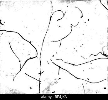 . Ein text-Buch auf die pathogenen Bakterien und Protozoen für Studenten der Medizin und Ärzte. Bakteriologie; pathogenen Bakterien und Protozoen. 36 Struktur und Klassifizierung von Mikroorganismen eine Spirale Organismus von Ribbon Form spiromonas aufgerufen wird, während ein ähnliches oganism der Spindel Form spirtdina genannt wird. Eine Spezies von spiralförmige Bakterien, in deren Zytoplasma Schwefel Granulat haben erkannt wurde ophidiomonas genannt worden. Spirale Organismen mit wellenförmigen Membranen sind als spirochceta bekannt, aber diese und ähnliche Gattung treponema sind jetzt als mehr richtig unter den Protozoen platziert Stockfoto