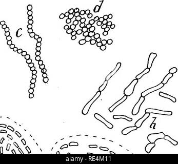 . Pharmazeutische Bakteriologie, mit besonderem Bezug auf die Desinfektion und Sterilisation. Bakteriologie. t) V,^^> AA/s. Abb. 10.- Illustration zooglea Bildung, ein. baciUar Aggregate resultmg frorti Zusammenhalt; b, Aggregate, die sich aus den Zusammenhalt von Bazillen mit gelatmized Cell-Wände; c, streptococcus Formation, die sich aus der Septierung der coccus Form; d, cohenng Kokken Formen; e, bacilU united Ende-zu-Ende (resultierend aus septierung), geschlossenen m eine gallertige Mantel;/, baciukr Thread in Gelatine; g, mycobakterien Form; h, unregelmäßige ceU Formen, wie Mycoderma aceti. Dennoch wurden sorgfältig Det Stockfoto