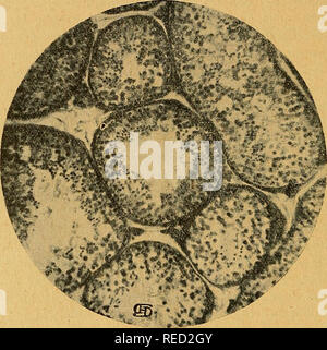 . Comptes Rendus de sÃ©ances de la SociÃ©tÃ© de Biologie et de ses filiales. Biologie. 830 SOCIÃTÃ DE BIOLOGIE bestehen." VNCe de la spermatogÃ © nÃ¨se nANS LE TESTICULE d'hOMMES TRÃS ALTER, par S. LeoÃ ¨ ne - J'ai Lu avec intÃ©rÃªt la Note de Pietterer sur le testicule du Â"^ ieil-larcl Â", parue dans ces Comptes Rendus (8 novembre 1919). Pour ma part, j'ai eu l'anlässlich d'enlever Trois fois au Cours d'Interventionen des chirurgicales testicules d'hommes d'un Ã¢ge avancÃ©: les Testi - cules n'Ã©taient Pas, par eux-mÃªmes malades; il fallut Les sacrifier Ã Ursache d'une nÃ©cessitÃ© de Technik OpÃ©Ratte Stockfoto