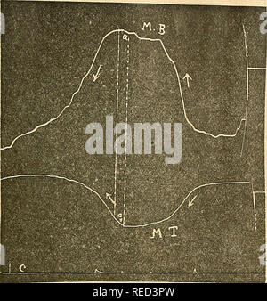 . Comptes Rendus de Séancen de la Société de Biologie et de ses filiales. Biologie. (17) SÉANCEN DES 21. avril 19 MAI, 9 ET 23 Juin 2013 547. Abb. I. - Kontraktion des Muskeln Bizeps MB et Trizeps MT dans les Mouve- Station Volontaires. La Flèche dirigée vers Le Zénith indique la Kontraktion. La Flèche dirigée Vers le Nadir mdique Le relâchement. C^ chronographe (Sekunden). Bitte beachten Sie, dass diese Bilder sind von der gescannten Seite Bilder, die digital für die Lesbarkeit verbessert haben mögen - Färbung und Aussehen dieser Abbildungen können nicht perfekt dem Original ähneln. extrahiert. Société d Stockfoto