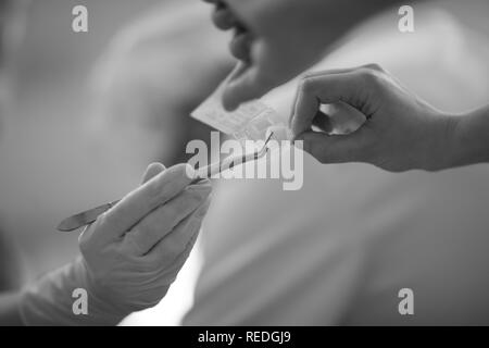 Ein Zahnarzt nimmt eine Einweg Tupfer mit Pinzette aus den Händen des Assistenten bei der Behandlung der Patienten. Stockfoto