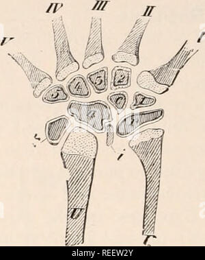 . Vergleichende Anatomie der Wirbeltiere. Anatomie, Vergleichende; Wirbeltiere. Vergleichende Anatomie n&gt; v. Abb. 126. - Mit der rechten Hand von Emy* Von oben. Ich, Intermedium; 7?, Radius; r. c, abgesichert radiale und Centrale; U, ulna; n, ulnare; t und *, Elemente auf der radial und ulnar Seite bzw. Hinweise auf zusätzliche radial und ulnar (pisiform 1! Holzstrahlen; 1--5, der carpalia, von denen 4 und 5 fixiert sind; /-V, metacarpals. Abb. 127,- LINKEN CARPUS OK Lm-i rln agilis. Von oben. c, Centrale; i, Intermedium; Li, Radius r, radiale, gebildet durch die Fusion von zwei Elemente, von denen eine entspricht einem Stockfoto