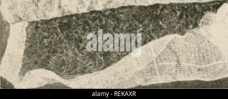 . Civic Biologie; Lehrbuch der Probleme, lokaler und nationaler Ebene, die nur durch die bürgerliche coöperation gelöst werden können. Biologie. ^^^ 9. Fi (ich. 143. Tiuy ("t ilul eijfjfs, mit in"> s-(| uito Net und Moos in wliirh sie verpackt waren, die ich 'nilc "Staaten" f FiNlicrirs liiircau ich sogar gut -.Si/t 11 hikrs Gleichgewicht verlieren kann, und bestimmte Arten können Suiter. Die weißen Bass in See! biidi' ich; ich, W'isounsin, im Sommer^889, starb in sucli iiiinibfrs, dass Schwaden auf dem Ufer gewaschen wurden, erfordern; thf rmioval von über * Jno wa^ onloads von der Meile oder so der Strand in Madison. Sie iiad iM' comr overcn & Stockfoto