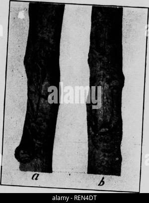 . Gemeinsame Insekten, Bäume [microform]. Schädlinge; Früchte; Insectes nuisibles; Obst. Abb. 34 Bitter Rot Käfer Schwein 35t" (nach burrill). ^^^ Das Spiel "R^ot *r* ^^"""""^- "Ken. üblichen Zrd ^^n": Er "b^aSr': fSd' t^^^^^^^^^^^^-- 3^^" diese Krankheit wird Eingang in das Gewebe durch Wunden JSf'''''' '•''^^"""""" von uns original Center, formfn, ein "eHes oTo^^" - "P* "'"^^° "t"'"'-d" wh.ch beachtliche Größe erreichen.' So Sn^ Th' "*" """""*^'^'^'^" f Aussehen. Die Diseas Stockfoto