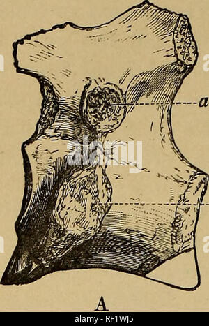 . Katalog der fossilen Reptilien und Amphibien im British Museum (Natural History)... Von Richard Lydekker... Reptilien, Amphibien, Fossil, Fossil. 246 ergänzen. Abb. 55.. Bitte beachten Sie, dass diese Bilder sind von der gescannten Seite Bilder, die digital für die Lesbarkeit verbessert haben mögen - Färbung und Aussehen dieser Abbildungen können nicht perfekt dem Original ähneln. extrahiert. British Museum (Natural History). Abt. der Geologie; Lydekker, Richard, 1849-1915. London, Gedruckt im Auftrag des Kuratoriums Stockfoto