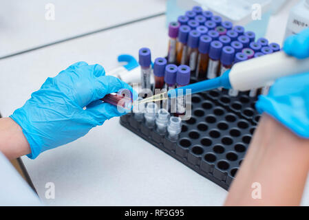 Blutprobe im Labor. Laboratory Assistant arbeiten mit dem Dispenser. Röhren mit Blut. Stockfoto