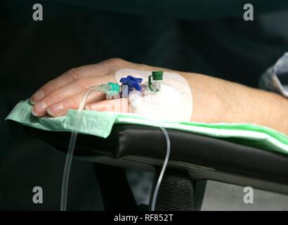 Patienten während der Operation, Infusion, Anästhesie, Deutschland Stockfoto