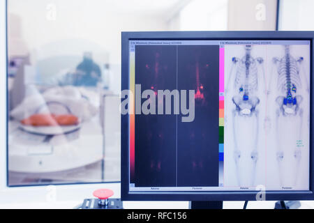 Isotope-Studie im Labor für Computertomographie. radioaktive Studie über die Erkennung von knochenkrebs Stockfoto