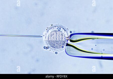 In-vitro-Fertilisation, Injektion von einem Spermium in die Eizelle Stockfoto