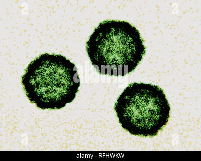 Coxsackievirus Viruspartikel, Illustration. Coxsackievirus Viruspartikel (Virionen) bestehen aus einer äusseren Proteinmantel (Kapsid) begrenzenden RNA (Ribonukleinsäure), das genetische Material des Virus. Coxsackievirus ist eine Art von Enterovirus. Es gehört zu den häufigsten und wichtigsten menschlichen Krankheitserregern, wodurch Erkältungen, virale Meningitis und myokarditis. Die Infektion breitet sich von Person zu Person, in der Regel auf ungewaschene Hände und Flächen mit Fäkalien, wo das Virus für mehrere Tage leben können verunreinigt. Coxsackie-viren sind unterteilt in Typ A und Typ B, Typ B, die Schwerste. Stockfoto