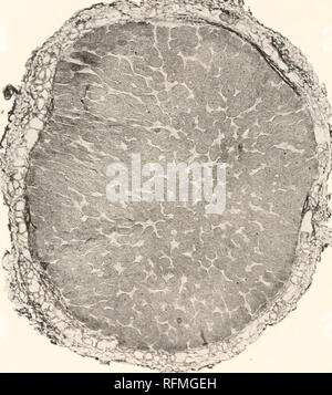 . Der Carnegie Institution in Washington Publikation. 104 BAKTERIEN IN BEZUG AUF PFLANZENKRANKHEITEN.mung bactcrioiden", und (3) Blase bacteroids. Die dritte Form, in der sich die Bakterien enorm vervielfacht haben. Die hcmmung s bactcrioiden Auftreten außerhalb des bacteroid Gewebe in fast allen äußeren Zellen der Knötchen, und nicht selten im normalen Rinde der Wurzel. Beyerinck festgestellt, dass die Mandeln nicht auf die Wurzeln der Pflanzen in sterilisierten Boden gewachsen zu entwickeln. Frank erreicht den gleichen Abschluss 1879, Hellriegel und Wilfarth in 1 S 86 Und ward im Jahre 1887. Pflanzen im Boden reich an Humus sind Stockfoto