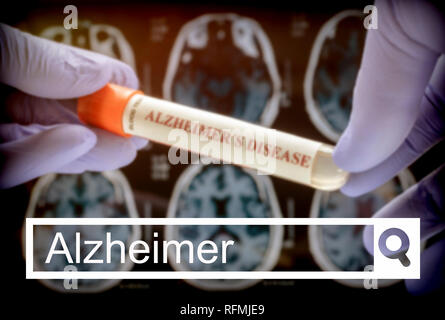 Suchen Sie in der Alzheimer Netzwerk, Wissenschaftler hält Blutprobe Abhilfe gegen die Alzheimer Krankheit zu untersuchen, konzeptionelle Bild Stockfoto