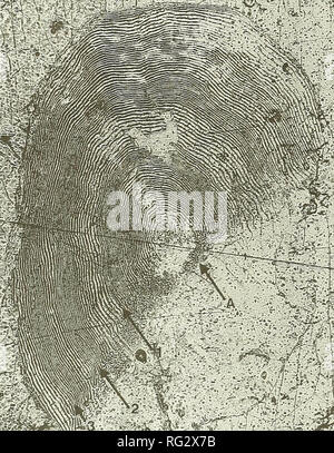 . Die kanadische Feld - naturforscher. 334 Die kanadische Field-Naturalist Vol. 110. Abbildung 3. Photomicrograph von einer Skala von der Vorbehandlung verwertungschancen Bereich der Chum salmon. Hinweis: der Mangel an Süßwasser Wachstum Zone, die kugelförmigen reticula- (A) Merkmal von Chum salmon (Bilton et al. 1964), und die drei annuli. Darüber hinaus ist das gesamte Erscheinungsbild der Skala ist die Eigenschaft von Chum salmon, mit mutiger, offener erscheinen, und breitere Schultern als ist offensichtlich auf der Waage der anderen Arten (Mosher 1969). Die individuellen ist Alter 0.4. Lachse laichen in der Adams River, anstatt ein Stockfoto