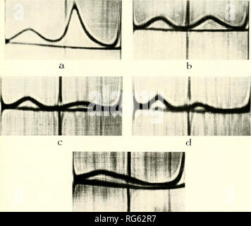 . Verkalkten Gewebe; Verfahren. Knochen; Kollagen; Verkalkung. Preliminarv Studien der Ultracentrifugal und Freie Zone Elektrophorese 273 wissen wir, dass Seine X-ray diffraction Pattern zeigt, dass die embryo-Emaille matrix ist in ein Kreuz-/i-Konfiguration (Glimcher et al., 1961). Vor kurzem hat es sich gezeigt, dass lösliche Emaille Protein aus rekonstituierte Lösung hat auch eine gut definierte Cross-/?-Konfiguration (Bonar et al., in press). Die Aminosäurezusammensetzung von Emaille Matrix zeichnet sich aus durch große Mengen von Proline, Glutaminsäure und Histidin (Glimcher et al., 1961 b). In jüngerer Zeit w Stockfoto