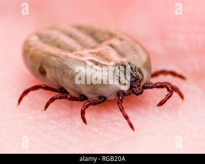 Enzephalitis Virus oder Lyme Krankheit infizierten Zecke Dermacentor Spinne Insekt auf der Haut Makro Stockfoto