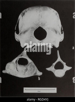 . Bulletin des Natural History Museum Zoologie. REDESCRIPTION DER CHINESISCHE WEISSE DELFIN 29 Tabelle 1 Klassifikation 5 Arten der Gattung Sousa nach morphologischen Unterschiede und geographische Verteilung (Ross ci u.a., 1994). Nominale Art Geographisches Spektrum S. chinensis (Osbeck. 1765) 5. plumbea (Cuvier, 1829) 5. lentigenosa (Owen, 1866) S. teuzii (Kukenthal, 1892) 5. Borneensis (lydekker. 1901) China Australien Südafrika Indien Indien nach Südostasien Westafrika seltene Form in Borneo, Überschneidungen mit "chinensis 'dann verglichen mit dem Angebot der Messungen Stockfoto