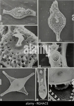 . Bulletin des British Museum (Natural History), Botanik. . Ich habe die Platte VII (a) - (d): Rutilaria areolata Subsp areolata, Labrador, Meer, Nordatlantik, (a): schräge Ventil Blick auf einzelnes Ventil, (SEM 70357); (b): Ventil Blick auf die gleiche Probe wie (a) (SEM 70348); (c): Detail der (b), zentralen Teil mit gebrochenen periplekton und tuberkel auf marginalen Stacheln (SEM 70352); (d): Detail der (b), an der Spitze der Ventil zeigt ocellus mit Hervorstehenden oberen Rand und geflügelte Costa, etwas durch Schmutz verdeckt, um die Höhe befestigt (SEM 70351). (A), (b), Bar = 5 | j, m; (c), (d), Bar = 1 Jim. (E) und (g): Rutilaria areol Stockfoto